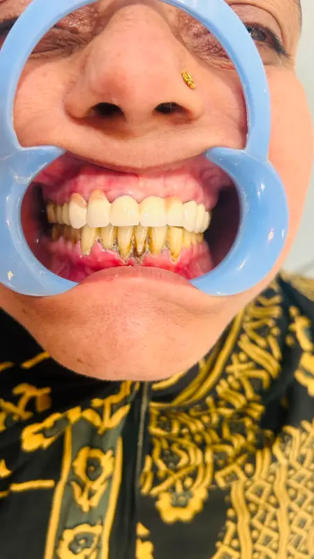 After treatment case 1