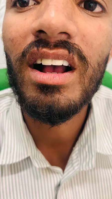 After treatment case 2