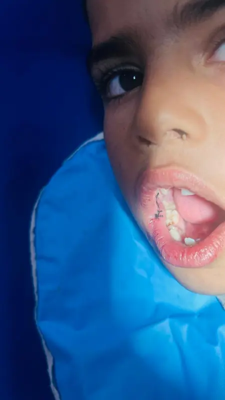 After treatment case 4