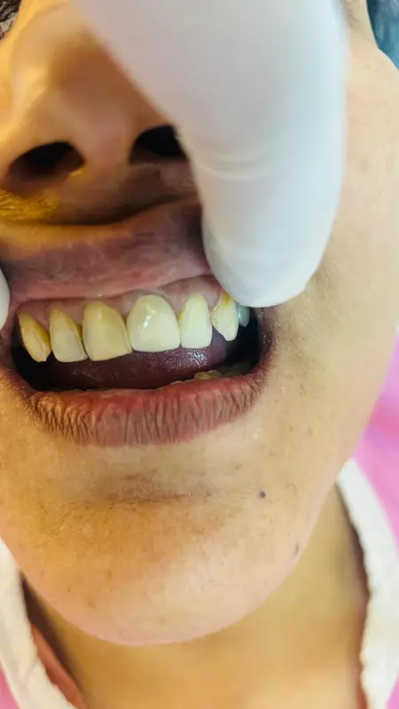 After treatment case 6