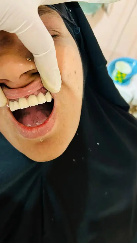 After treatment case 7