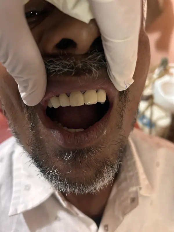 After treatment case 8