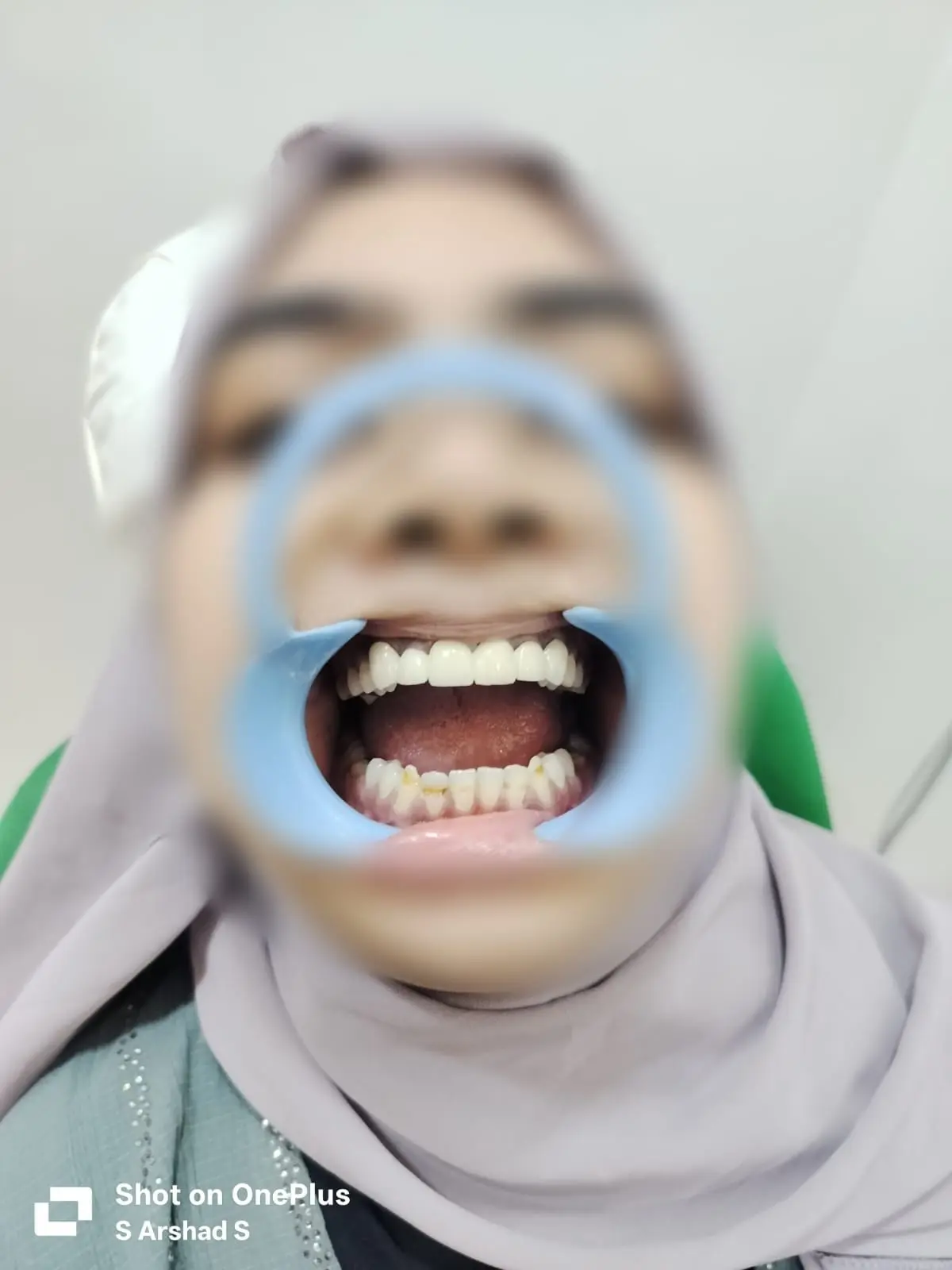 After treatment case 9