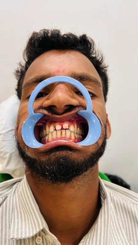 Before treatment case 2