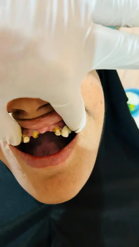 Before treatment case 7