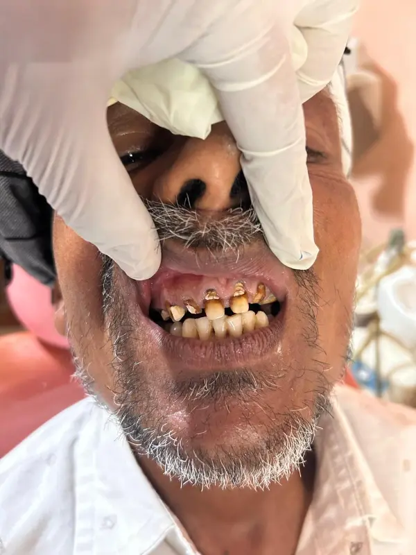 Before treatment case 8